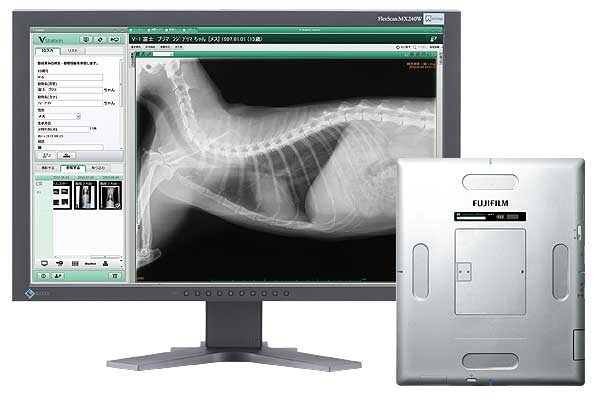 デジタルレントゲン装置